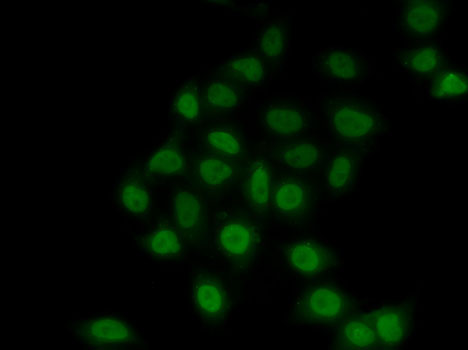 TEAD1 Rabbit Polyclonal Antibody - Image 6