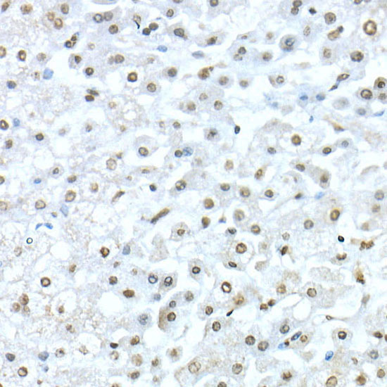TEAD1 Rabbit Polyclonal Antibody - Image 3