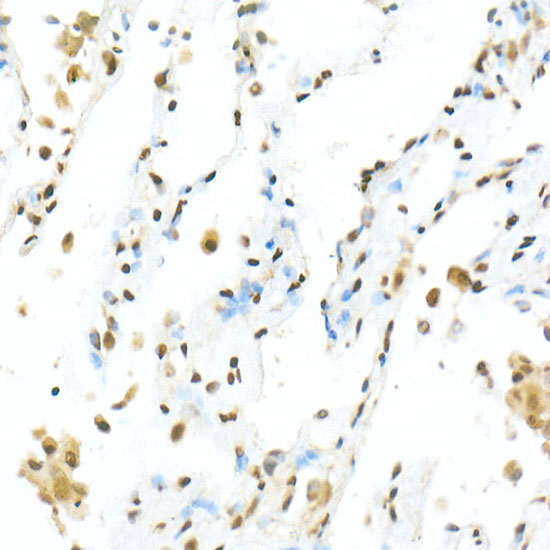 TEAD1 Rabbit Polyclonal Antibody - Image 4