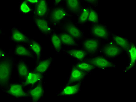 TEAD1 Rabbit Polyclonal Antibody - Image 5