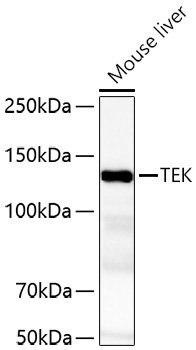 TEK Rabbit Polyclonal Antibody