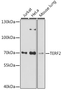TERF2 Rabbit Polyclonal Antibody