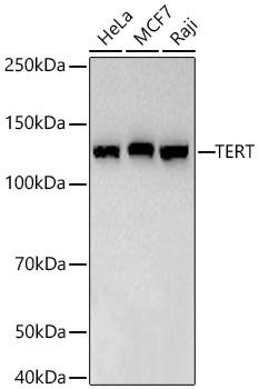 TERT Rabbit Monoclonal Antibody