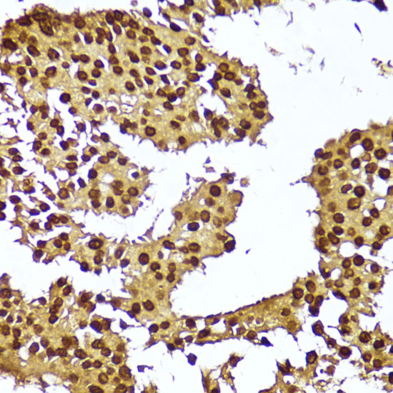 TERT Rabbit Polyclonal Antibody