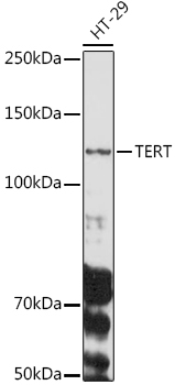 TERT Rabbit Polyclonal Antibody
