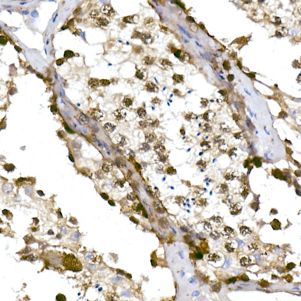 TET1 Rabbit Monoclonal Antibody