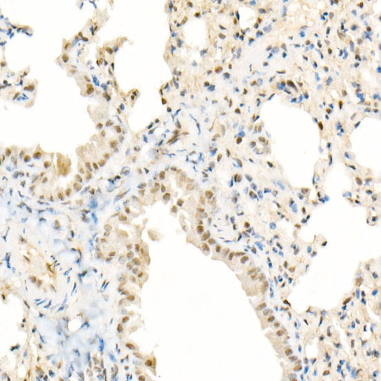 TFEB Rabbit Monoclonal Antibody