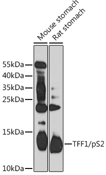 TFF1/pS2 Rabbit Polyclonal Antibody