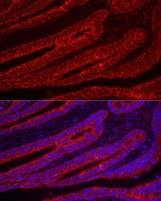 TFF3 Rabbit Polyclonal Antibody