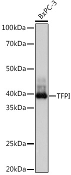 TFPI Rabbit Monoclonal Antibody