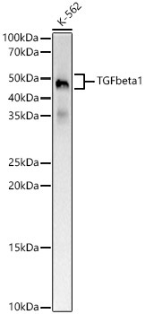 TGF beta 1 Rabbit Monoclonal Antibody