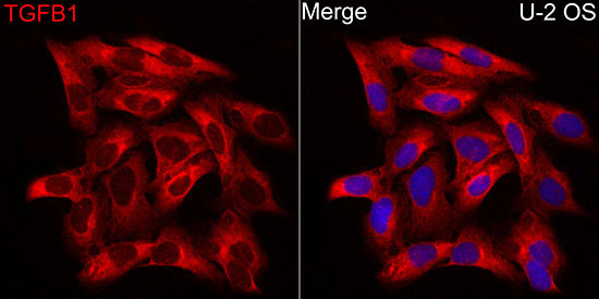 TGF beta 1 Rabbit Polyclonal Antibody