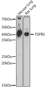 TGF beta 1 Rabbit Polyclonal Antibody