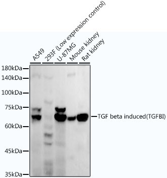 TGF beta induced (TGFBI) Rabbit Monoclonal Antibody