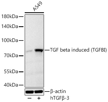 TGF beta induced (TGFBI) Rabbit Monoclonal Antibody