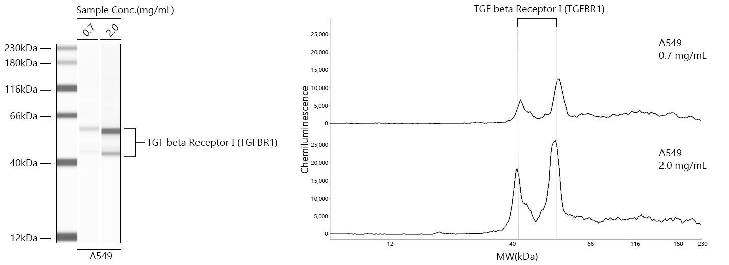 TGF beta Receptor I (TGFBR1) Rabbit Monoclonal Antibody
