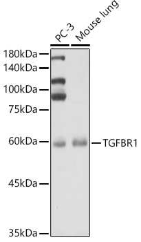 TGF beta Receptor I (TGFBR1) Rabbit Polyclonal Antibody