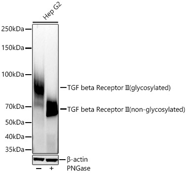 TGF beta Receptor II Rabbit Monoclonal Antibody