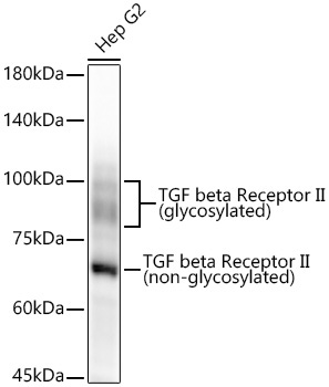 TGF beta Receptor II Rabbit Monoclonal Antibody