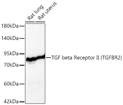 TGF beta Receptor II Rabbit Polyclonal Antibody