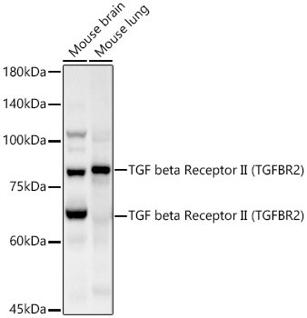 TGF beta Receptor II Rabbit Polyclonal Antibody