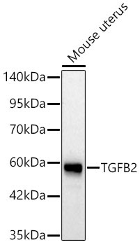 TGFB2 Rabbit Polyclonal Antibody