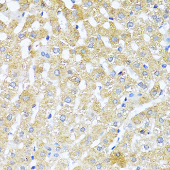 TGFB2 Rabbit Polyclonal Antibody