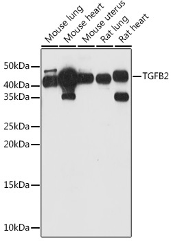 TGFB2 Rabbit Polyclonal Antibody