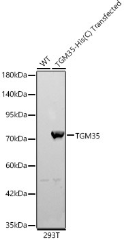TGM3 Rabbit Polyclonal Antibody