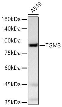 TGM3 Rabbit Polyclonal Antibody