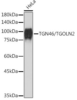 TGN46/TGOLN2 Rabbit Monoclonal Antibody