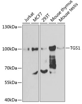 TGS1 Rabbit Polyclonal Antibody