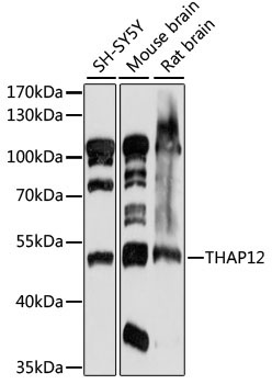 THAP12 Rabbit Polyclonal Antibody
