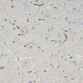 THBS1 Rabbit Polyclonal Antibody