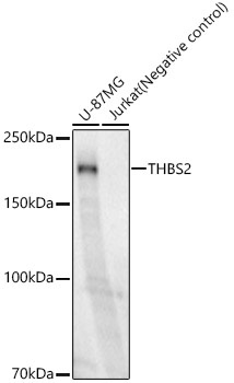 THBS2 Rabbit Monoclonal Antibody