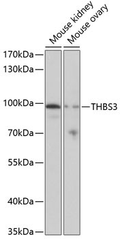 THBS3 Rabbit Polyclonal Antibody