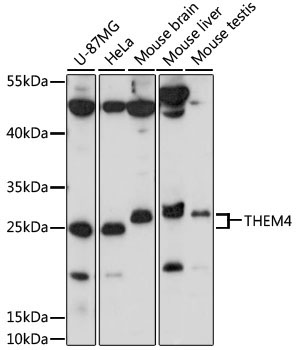 THEM4 Rabbit Polyclonal Antibody