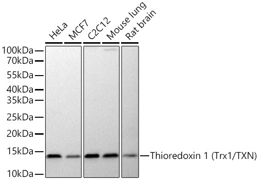 Thioredoxin 1 (Trx1/TXN) Rabbit Monoclonal Antibody