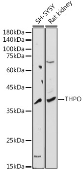 THPO Rabbit Polyclonal Antibody