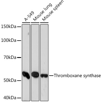 Thromboxane synthase Rabbit Monoclonal Antibody