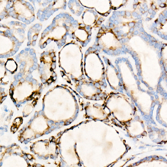 Thyroid Peroxidase Rabbit Monoclonal Antibody