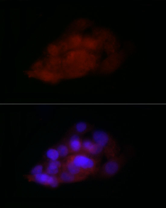 TIA1 Rabbit Polyclonal Antibody - Image 2