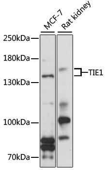 TIE1 Rabbit Polyclonal Antibody