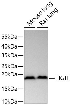 TIGIT Rabbit Polyclonal Antibody