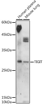 TIGIT Rabbit Polyclonal Antibody