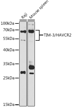 TIM-3/HAVCR2 Rabbit Polyclonal Antibody
