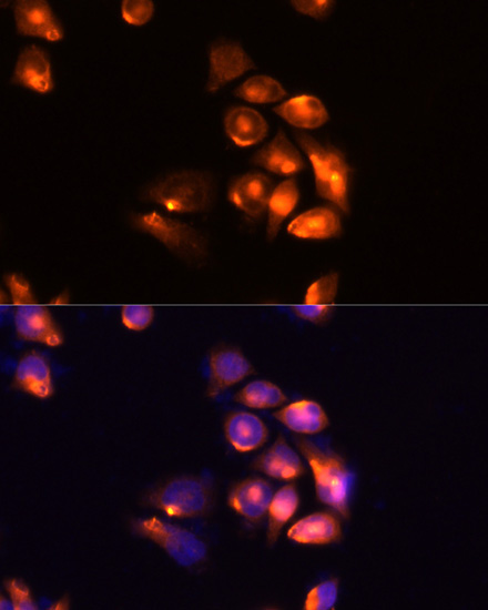 TIM-3/HAVCR2 Rabbit Polyclonal Antibody - Image 2