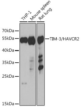 TIM-3/HAVCR2 Rabbit Polyclonal Antibody