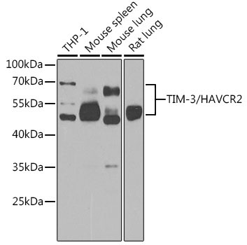TIM-3/HAVCR2 Rabbit Polyclonal Antibody