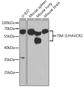 TIM-3/HAVCR2 Rabbit Polyclonal Antibody